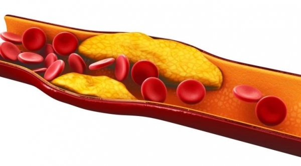 Поликозанол против плохого холестерина в крови