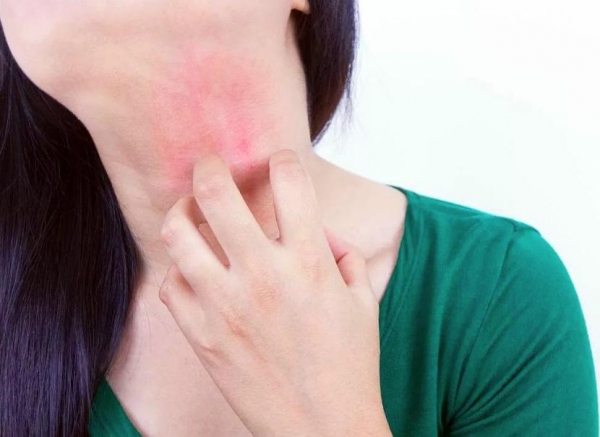 Аллергия на аскорбиновую кислоту - симптомы и причины